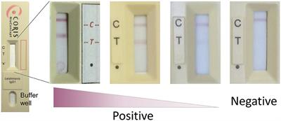 Visceral Leishmaniasis IgG1 Rapid Monitoring of Cure vs. Relapse, and Potential for Diagnosis of Post Kala-Azar Dermal Leishmaniasis